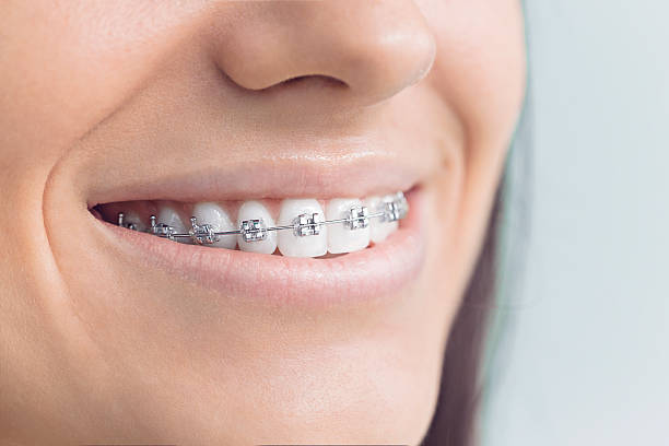 Best Wisdom Tooth Removal  in Montebello, CA